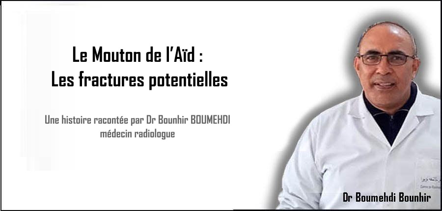 Le Mouton de l’Aïd : Les fractures potentielles