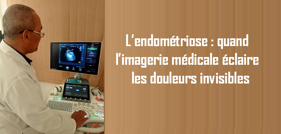 L’endométriose : quand l’imagerie médicale éclaire les douleurs invisibles