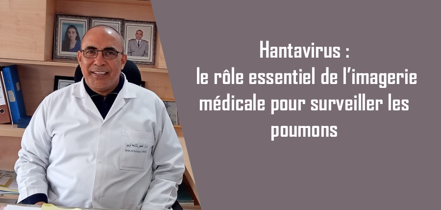 Hantavirus : le rôle essentiel de l’imagerie médicale pour surveiller les poumons