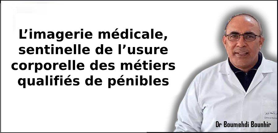 L’imagerie médicale, sentinelle de l’usure corporelle des métiers qualifiés de pénibles