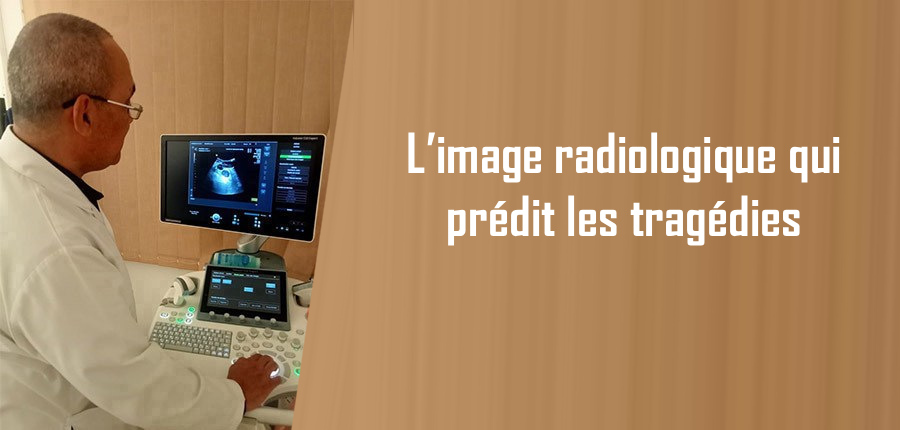 L’image radiologique qui prédit les tragédies