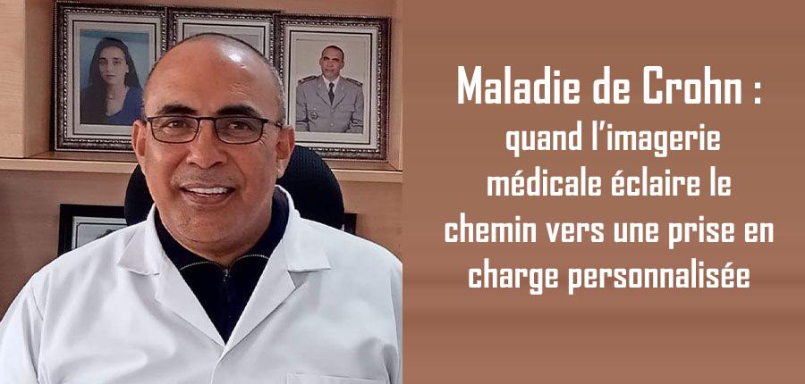Maladie de Crohn : quand l’imagerie médicale éclaire le chemin vers une prise en charge personnalisée 