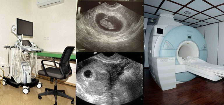 echo rayon x lopera 15082017001