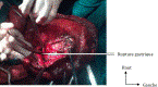 figure4