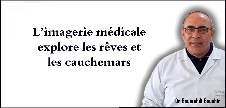 L’imagerie médicale explore les rêves et les cauchemars