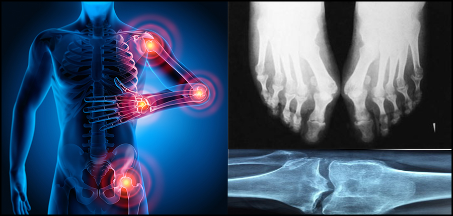 imagerie medicale et le rhumatisme 001233654