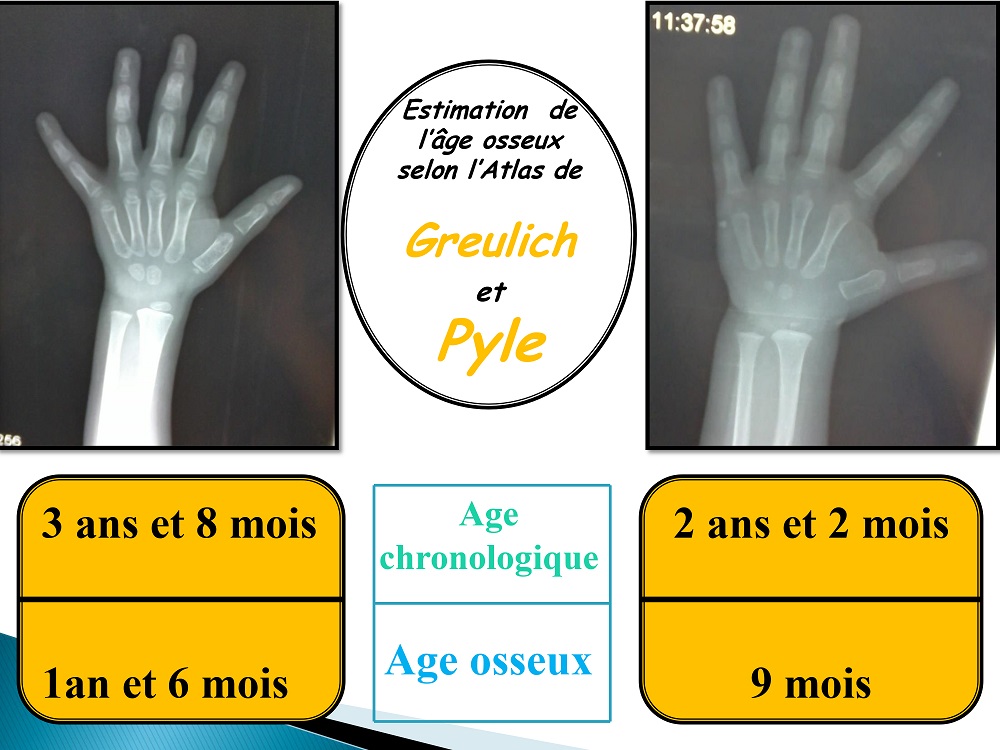 imagerieretardstatruroponderal 1022022017