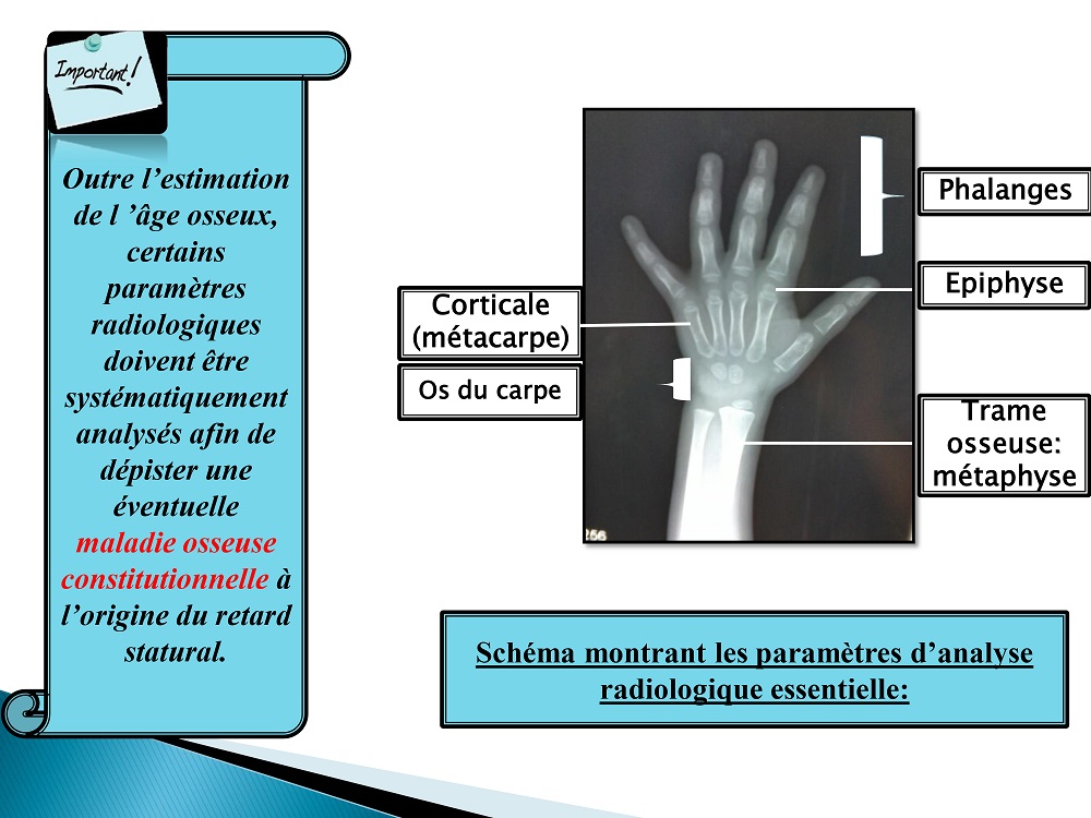 imagerieretardstatruroponderal 1122022017