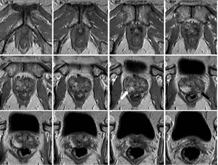 irm prostate radiologielopera2017