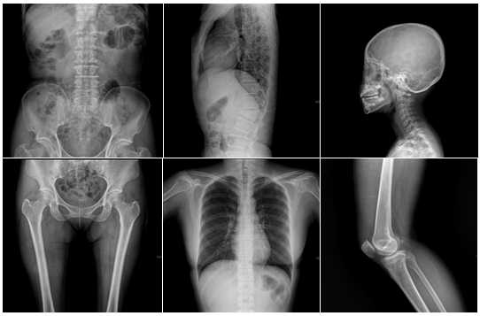 radiographie0011